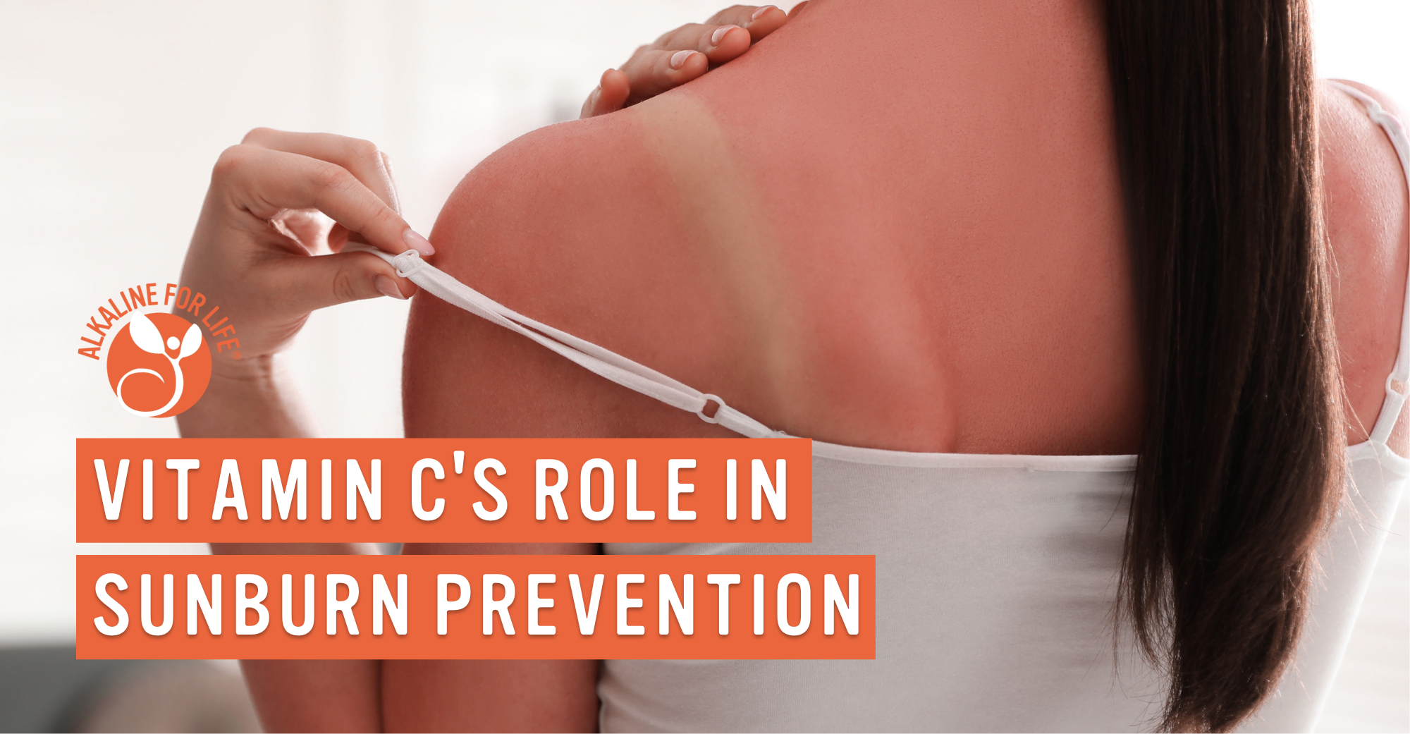 Vitamin C and sunburn